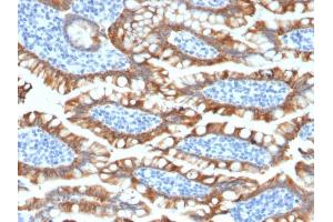 Formalin-fixed, paraffin-embedded human Small Intestine stained with Cytokeratin 8 Rabbit Recombinant Monoclonal Antibody (KRT8/2174R). (Recombinant KRT8 antibody)