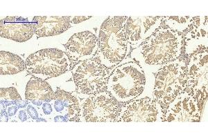 Immunohistochemistry of paraffin-embedded Mouse testis tissue using Smad4 Polyclonal Antibody at dilution of 1:200. (SMAD4 antibody)
