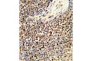 Formalin-fixed and paraffin-embedded human spleen tissue reacted with CYP24A1 Antibody , which was peroxidase-conjugated to the secondary antibody, followed by DAB staining. (CYP24A1 antibody  (C-Term))
