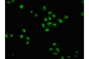 Immunofluorescence staining of Hela cells with ABIN7176203 at 1:100, counter-stained with DAPI. (ZNF268 antibody  (AA 416-603))