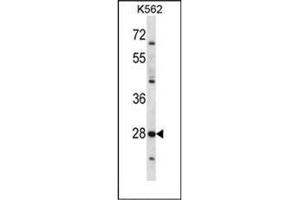Western blot analysis of PRSS27 Antibody (C-term) .