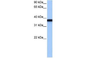 GSG1 antibody used at 1 ug/ml to detect target protein. (GSG1 antibody  (C-Term))