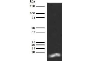 Western Blotting (WB) image for anti-Brain Natriuretic Peptide 45 (BNP-45) antibody (Biotin) (ABIN613019)
