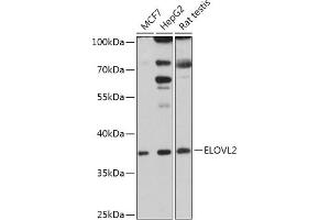 Western blot analysis of extracts of various cell lines, using ELOVL2 antibody (ABIN7266927) at 1:1000 dilution. (ELOVL2 antibody  (AA 247-296))