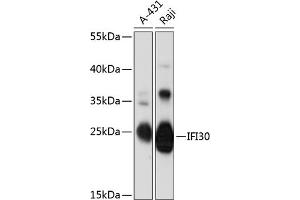 Western blot analysis of extracts of various cell lines, using IFI30 antibody (ABIN6131997, ABIN6142166, ABIN6142167 and ABIN6216814) at 1:3000 dilution. (IFI30 antibody  (AA 1-250))