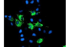 Anti-SIRT5 mouse monoclonal antibody (ABIN2454823) immunofluorescent staining of COS7 cells transiently transfected by pCMV6-ENTRY SIRT5 (RC200189). (SIRT5 antibody)