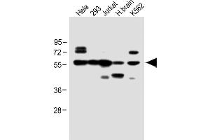 All lanes : Anti-IFNAR1 Antibody (Center) at 1:1000 dilution Lane 1: Hela whole cell lysate Lane 2: 293 whole cell lysate Lane 3: Jurkat whole cell lysate Lane 4: H. (IFNAR1 antibody  (AA 162-188))