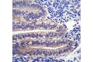 ANGPTL7 antibody immunohistochemistry analysis in formalin fixed and paraffin embedded human uterus tissue. (ANGPTL7 antibody  (AA 300-350))