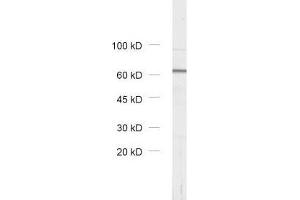 dilution: 1 : 1000, sample: rat brain homogenate (VPS33A antibody)