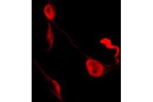 ABIN6278651 staining K562 by IF/ICC. (Ephrin B1/B2/B3 (pTyr324) antibody)