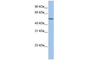 SLC16A6 antibody used at 1 ug/ml to detect target protein. (SLC16A6 antibody)