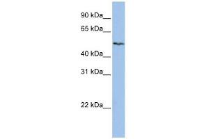 SLC16A6 antibody used at 1 ug/ml to detect target protein.