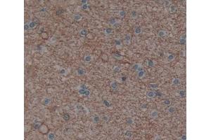 Used in DAB staining on fromalin fixed paraffin- embedded brain tissue (PLCH1 antibody  (AA 1-237))