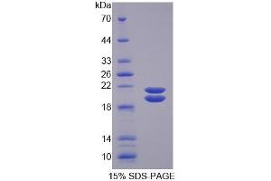 SDS-PAGE of Protein Standard from the Kit  (Highly purified E. (SFTPD ELISA Kit)