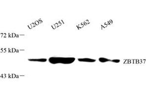Western blot analysis of ZBTB37 (ABIN7076249) at dilution of 1: 2000 (ZBTB37 antibody)