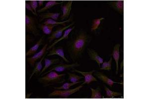 Image no. 2 for anti-Activating Transcription Factor 2 (ATF2) (Thr53), (Thr71) antibody (ABIN197148) (ATF2 antibody  (Thr53, Thr71))