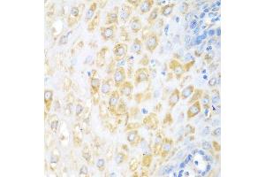 Immunohistochemistry of paraffin-embedded human esophagus using BECN1 antibody at dilution of 1:100 (40x lens). (Beclin 1 antibody)