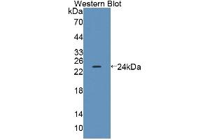 Western blot analysis of the recombinant protein. (ACADS antibody  (AA 210-397))
