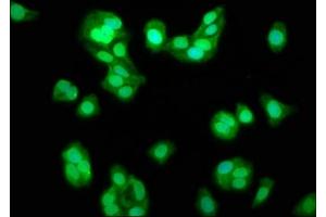Immunofluorescence staining of HepG2 cells with ABIN7164441 at 1:133, counter-stained with DAPI. (TRIM8 antibody  (AA 367-517))