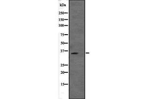 Western blot analysis of VGLL2 expression in VGLL2 transfected 293T cell lysate,The lane on the left is treated with the antigen-specific peptide. (VGLL2 antibody  (Internal Region))