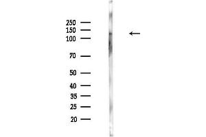 Western blot analysis of lysates from Hela cells(heat-shock,45 min treatment), using Anillin Antibody at 1/1000 dilution.