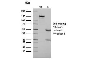 SDS-PAGE Analysis Purified p73 Mouse Monoclonal Antibody (P73/2531). (Tumor Protein p73 antibody)