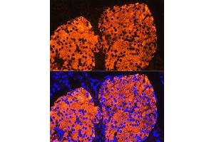Immunofluorescence (IF) image for anti-Insulin (INS) (AA 1-110) antibody (ABIN3022885)