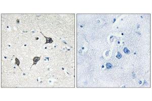 Immunohistochemistry (IHC) image for anti-G Protein-Coupled Receptor 20 (GPR20) (C-Term) antibody (ABIN1853030) (GPR20 antibody  (C-Term))