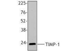 Western Blotting (WB) image for anti-TIMP Metallopeptidase Inhibitor 1 (TIMP1) antibody (ABIN2666373) (TIMP1 antibody)