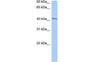 WB Suggested Anti-DCP2 Antibody Titration:  0. (DCP2 antibody  (C-Term))