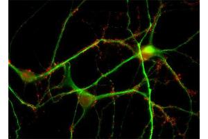 Indirect immunofluorescence labeling of PFA fixed rat hippocampus neurons with anti-synaptogyrin (dilution 1 : 500; red) and anti-MAP 2 (cat. (Synaptogyrin 1 antibody  (AA 220-234))