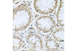 Immunohistochemistry of paraffin-embedded human stomach using HPS1 antibody. (HPS1 antibody)