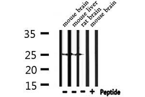 Western blot analysis of extracts from mouse brain, mouse liver, rat brain, using RND2 Antibody. (RND2 antibody  (Internal Region))