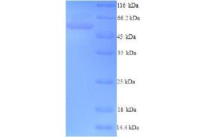 SDS-PAGE (SDS) image for F-Box Protein 3 (FBXO3) (AA 1-471), (full length) protein (His tag) (ABIN4975799)