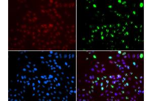 Immunofluorescence analysis of GFP-RNF168 transgenic U2OS cells using MSH6 antibody. (MSH6 antibody)