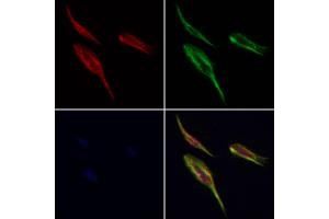 Ribophorin I Antibody staining Hela cells by IF/ICC.