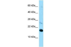 Western Blotting (WB) image for anti-Ribosomal Protein L22 (RPL22) (C-Term) antibody (ABIN2789541) (RPL22 antibody  (C-Term))