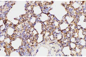 Immunohistochemistry of paraffin-embedded Rat lung using FGA Polycloanl Antibody at dilution of 1:100 (FGA antibody)
