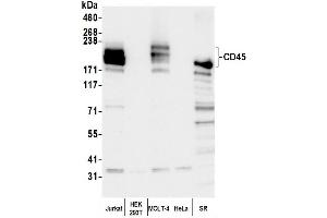 Western Blotting (WB) image for anti-Protein tyrosine Phosphatase, Receptor Type, C (PTPRC) (AA 1254-1304) antibody (ABIN7455221)