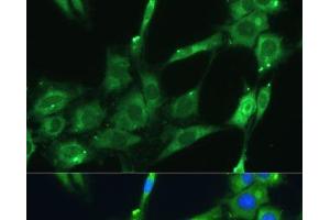 Immunofluorescence analysis of C6 cells using SPARC Polyclonal Antibody at dilution of 1:100 (40x lens). (SPARC antibody)