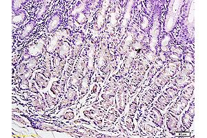 Formalin-fixed and paraffin embedded human gastric tissue labeled with Anti-Leptin Polyclonal Antibody (ABIN668243), Unconjugated at 1:300, followed by conjugation to the secondary antibody and DAB staining (Leptin antibody  (AA 17-100))