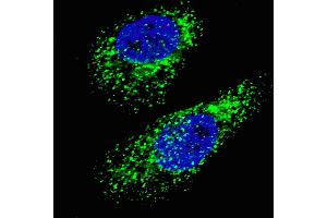 Fluorescent image of  cells stained with LC3 (G8A)  antibody. (MAP1LC3A antibody  (AA 91-117))