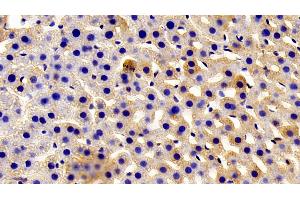 Detection of AZIN1 in Rat Liver Tissue using Polyclonal Antibody to Antizyme Inhibitor 1 (AZIN1) (Antizyme Inhibitor 1 antibody  (AA 1-280))
