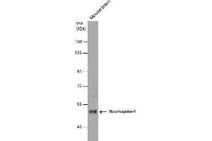 WB Image Mouse tissue extract (50 μg) was separated by 7. (Neuregulin 1 antibody)