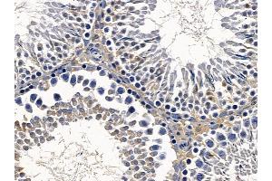 ABIN6259071 and ABIN6273601 at 1/100 staining rat testis tissue by IHC-P.