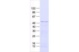 Validation with Western Blot (ZIC1 Protein (His tag))