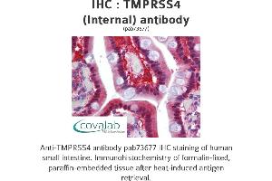 Image no. 1 for anti-Transmembrane Protease, serine 4 (TMPRSS4) (Internal Region) antibody (ABIN1740176) (TMPRSS4 antibody  (Internal Region))