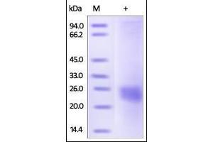 Mouse VEGF164 on SDS-PAGE under reducing (R) condition. (VEGF Protein (AA 27-190))