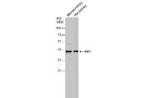 WB Image Various tissue extracts (50 μg) were separated by 10% SDS-PAGE, and the membrane was blotted with RAP antibody [N1C3] , diluted at 1:1000. (LRPAP1 antibody  (Center))