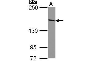 Western Blotting (WB) image for anti-Tripartite Motif Containing 24 (TRIM24) (AA 82-399) antibody (ABIN1501502) (TRIM24 antibody  (AA 82-399))